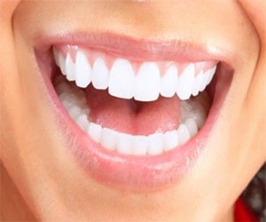 White Fillings